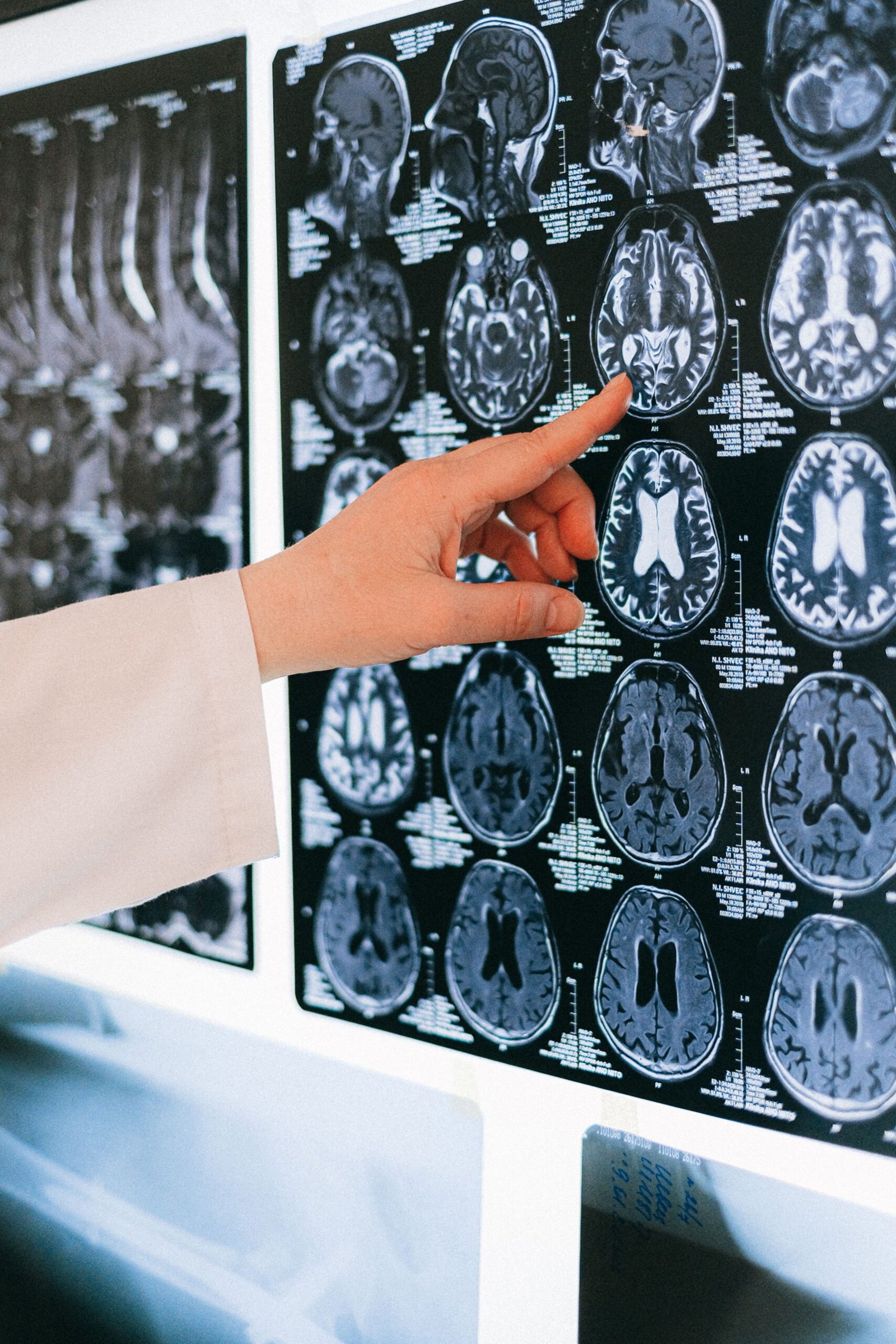Dr Bernard Srour : « Alimentation et cancer, ce que dit vraiment la science »